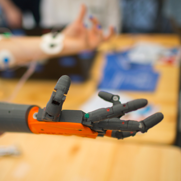 Just for Me: Prosthetics Tech